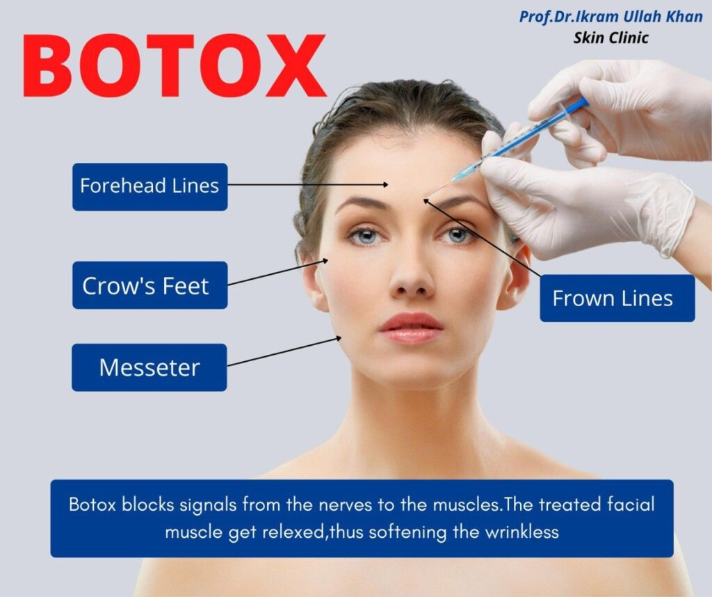 How Botox Works