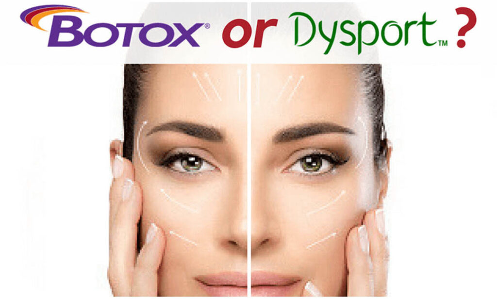 Dysport vs Botox