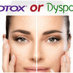 Dysport vs Botox